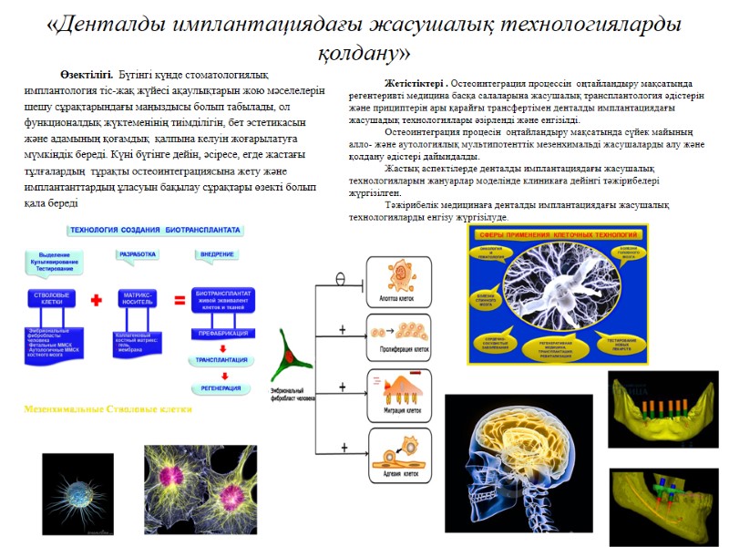 «Денталды имплантациядағы жасушалық технологияларды қолдану» Өзектілігі.  Бүгінгі күнде стоматологиялық имплантология тіс-жақ жүйесі ақаулықтарын